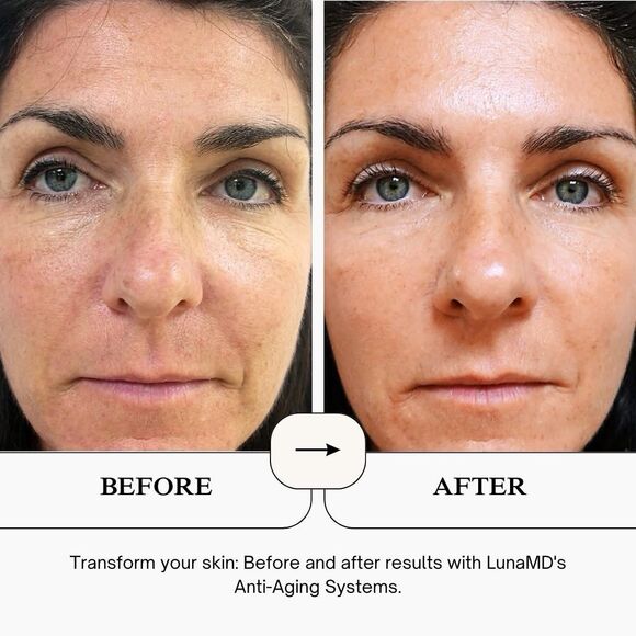 NEW LunaMD Multi-Complex Night Cream 1.7oz Anti Aging Moisturizer Hydration Lift - Picture 11 of 14